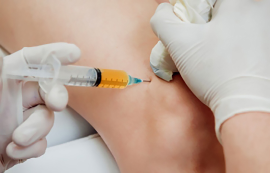 Diz Ağrısı İçin PRP