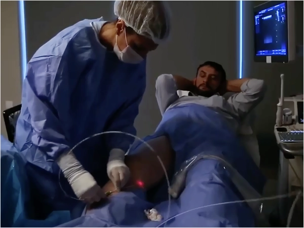 Endovenöz Lazer Ablasyon Varis Tedavisi