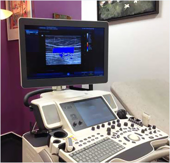 Venöz Doppler Ultrason